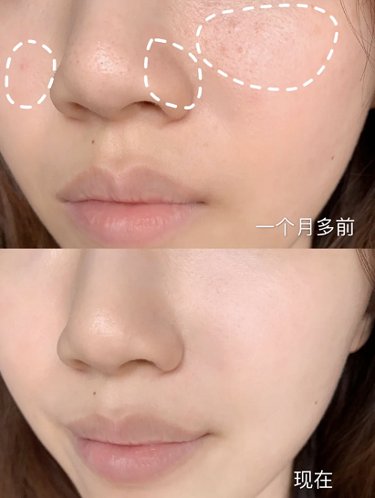 护肤品|最不值得买的“网红”护肤品,孕期用完“烂脸”,孕妇们别跟风