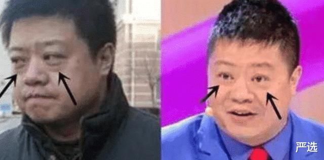 严选|37岁戚薇眼角看不到皱纹，大方给出保养方法，网友：难怪显年轻