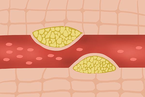 戒烟|吃猪血拉黑便，是身体有问题，还是能清肺？或许答案和你想的不一样