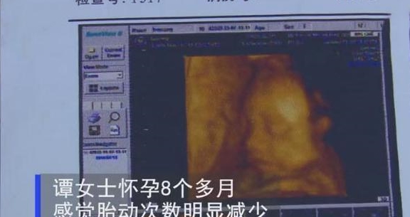 怀孕妈妈知识宝典|胎儿缺氧后果严重,3个方法判断“是否缺氧”