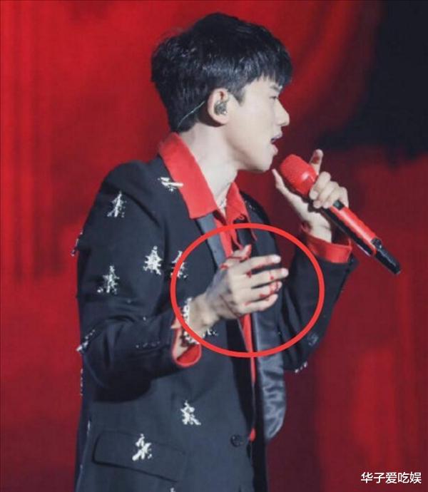 张杰|张杰演唱会受伤，高举血手演唱，赞美声铺天盖地，遭网友质疑炒作
