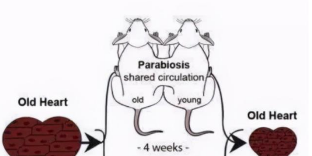 |富豪为完成活到120岁的心愿，3个月换一次血，科学证明：确实有效