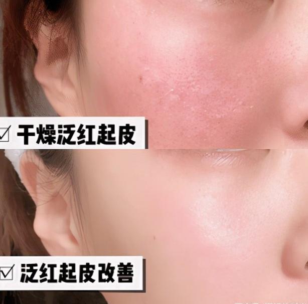 杏鲍菇 婚后的女人，护肤品不要选“网红款”，入手这3种就够，经济适用