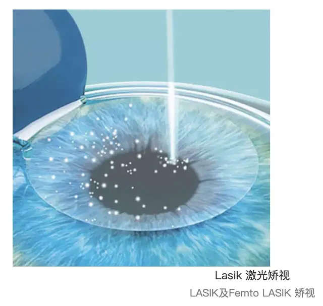 野马财经 10名眼科医生撑起2亿港元营收！夫妻店“药明系”将再获1家上市