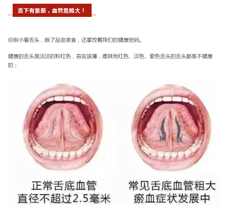 红枣|舌头长这样,你血管的保质期到了,心脑血管疾病容易找上门!每周一碗它,扩张血管还护心!