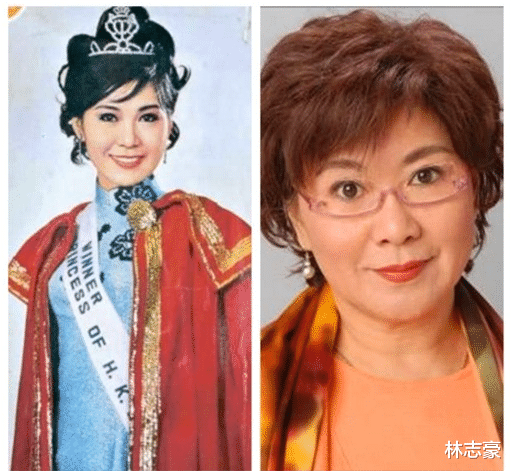 张国荣|18位女星的今昔对比照,有人整容失败,有人死后墓地被毁,还有张国荣的初恋