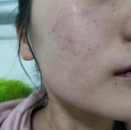 大脑|护肤品不一定用贵的，这6款护肤品公认好用不贵，孕妇可用