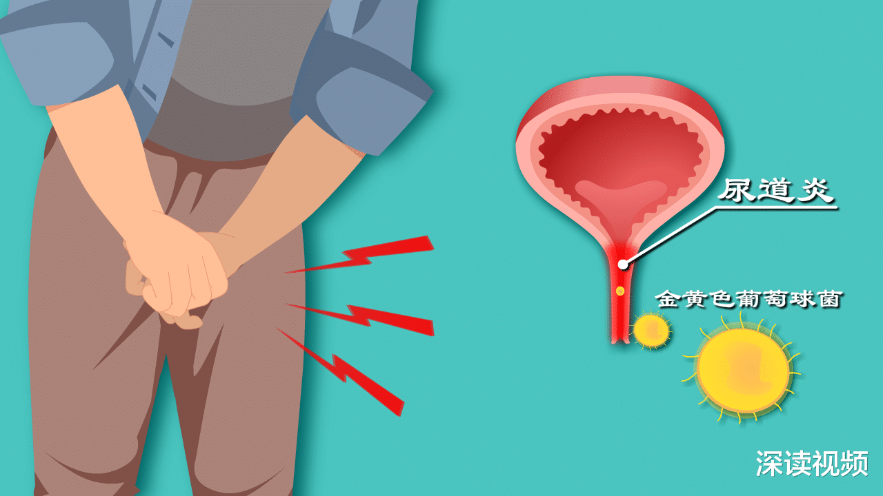 尿道炎|好好的咋就尿道炎了？为啥尿痛、尿频，还尿急？解密尿道炎发病机制