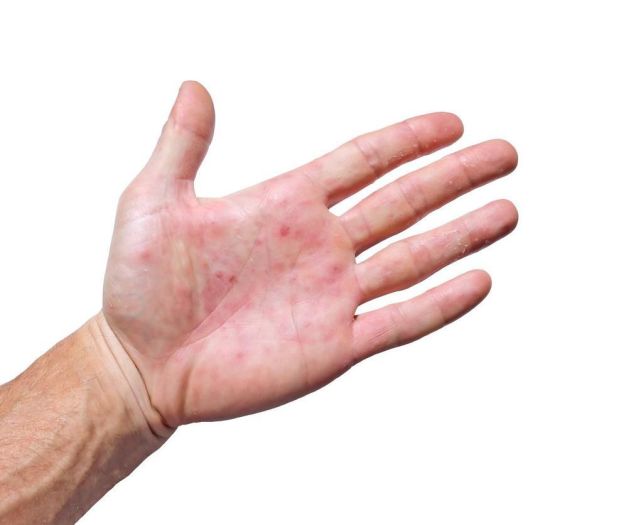 乐禹萱|肝脏好不好，看手就知道，若没有这3个表现，恭喜肝脏还算健康