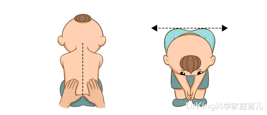 DrKing科学家庭育儿|8岁娃脊柱侧弯成“折叠人”:整个青春期,我都活在壳子里