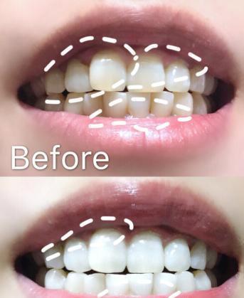 好物官|我国“最低调国宝”牙膏,因太便宜被无视,网友:用后牙黄牙渍消失了