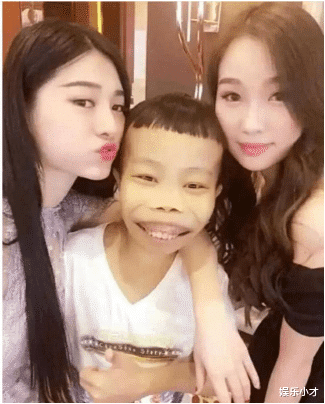 陈山|“龅牙怪”陈山的覆灭史:曾经的“卖丑”网红鼻祖,如今凄惨异常