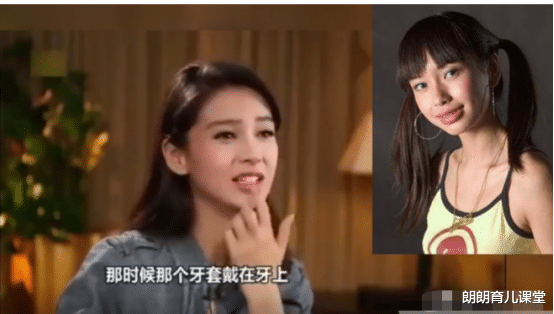 傅园慧|有种“整容”叫傅园慧，整牙后判若两人，网友：终于相信baby了