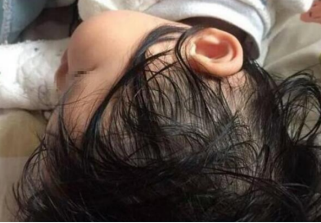 胆固醇|10岁女童半年内突增14厘米，儿科：此物是“身高助长剂”，可多食