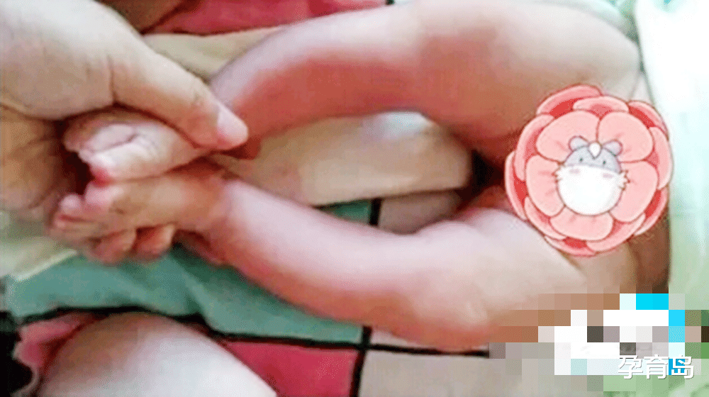 孕育岛|宝宝”青蛙腿“怎么办？顺其自然就好，可惜很多妈妈还在听老人的