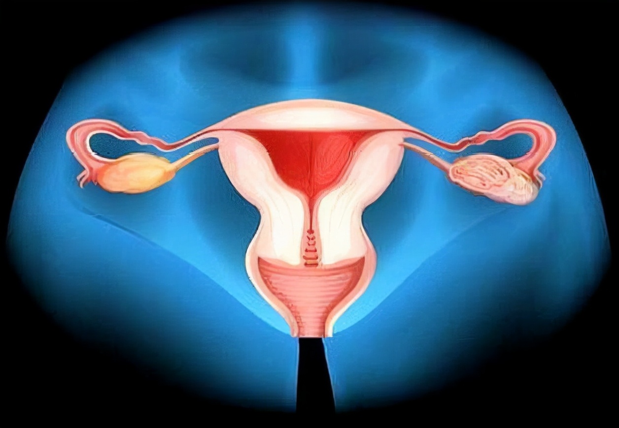 宫颈癌|宫颈癌出现，身体会呈现出这4个信号，及时发现，趁早就医