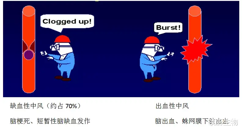 脑卒中|脑卒中并非“卒”不及防!防治牢记这4点!