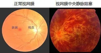 康小灵 这2项体检项目，很多人选择“逃检”，却是不可或缺的检查