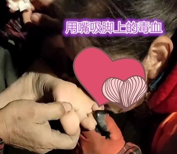 不讲卫生?大妈蹲路边用嘴吸大爷脚上“毒血”,网友:不怕脏吗