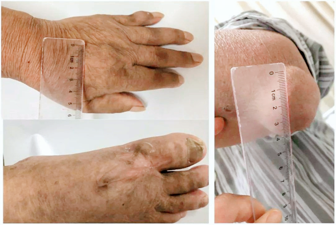 抗生素|吃一次相当于10斤猪肺,呼吸科主任:肺不好的人可多吃,肺脏越活越有力