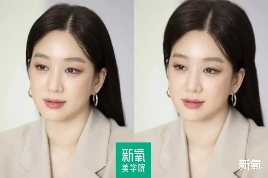 发际线 每个人造美女，都畏惧这种地狱级变美难度的骨相
