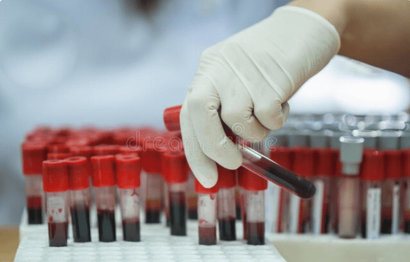 体检|盘点降肌酐的3个方法，可保护肾功能，总有一种适合你