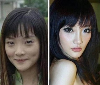 整容|内娱“假鼻子”大PK，谁的假到逆天，谁的越整越残？