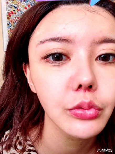 宋祖德|兜儿直播时卸妆，鼻子红肿像整容后留的疤痕，与韩安冉有一拼