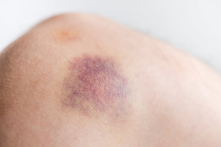 肿瘤|胸部和背部出现异常信号,癌症或已经来临,最好去检查一下!