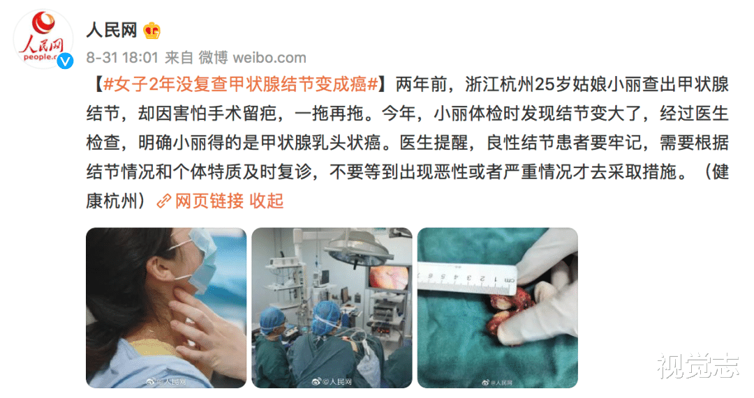 视觉志|拿到你的体检报告，小心「结节」二字。