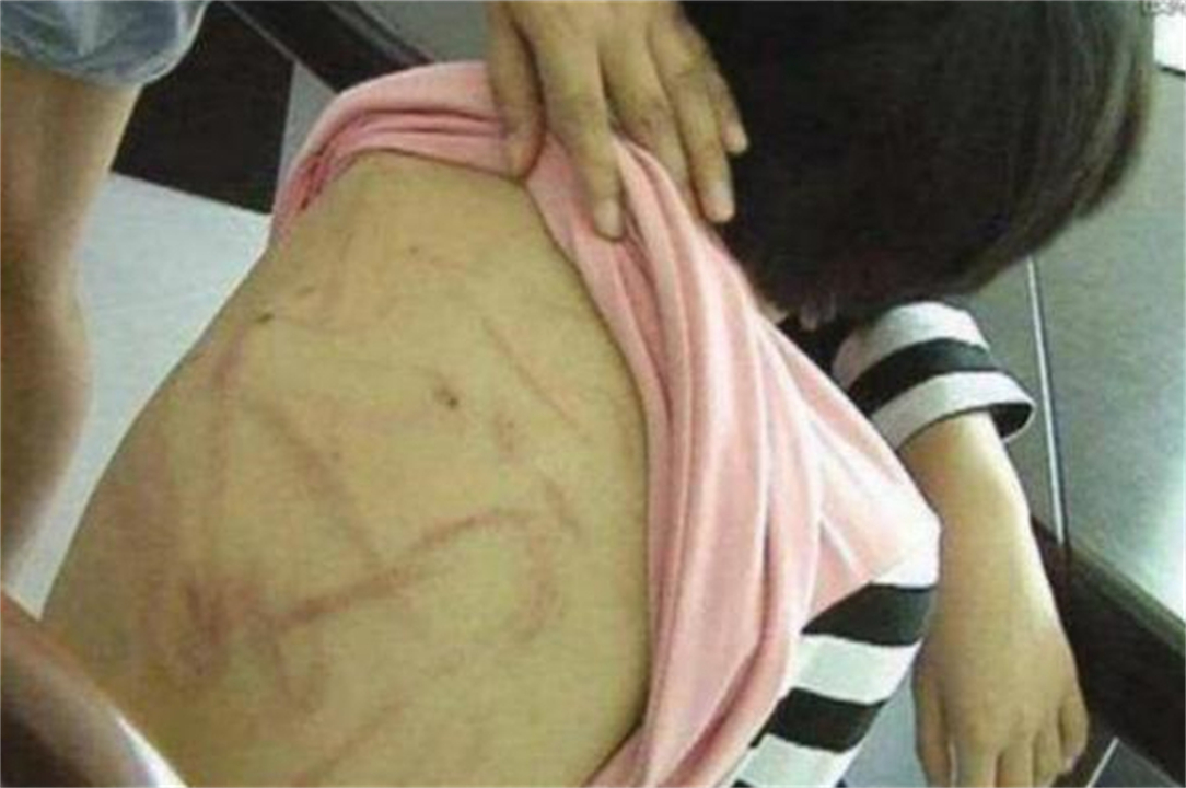 家暴 7岁女儿生病发烧，边哭边念叨着“洗衣机”，妈妈打开后“崩溃”