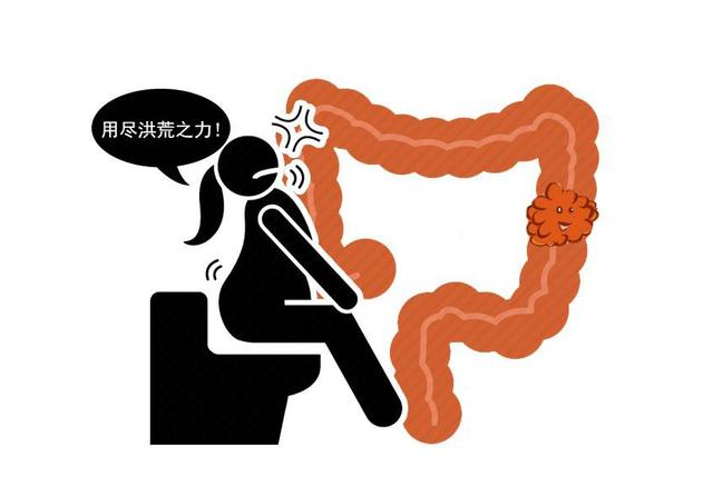 医生胡侃|人体内真的有宿便吗？提醒：多做5件事，改善肠道健康