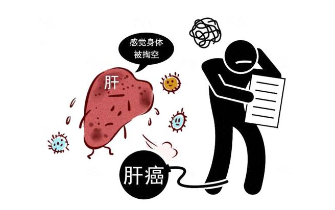 医生胡侃|年年体检正常，为何肝癌还会找上门？提醒：很多人弄错这个细节