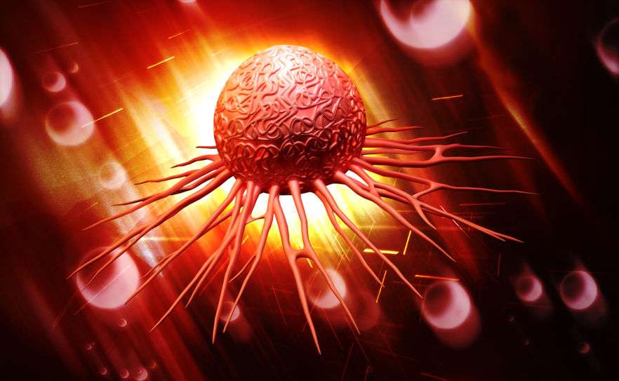 肺腺癌|肺腺癌来临时，身体会出现这6个不适，需多留心观察，别忽视