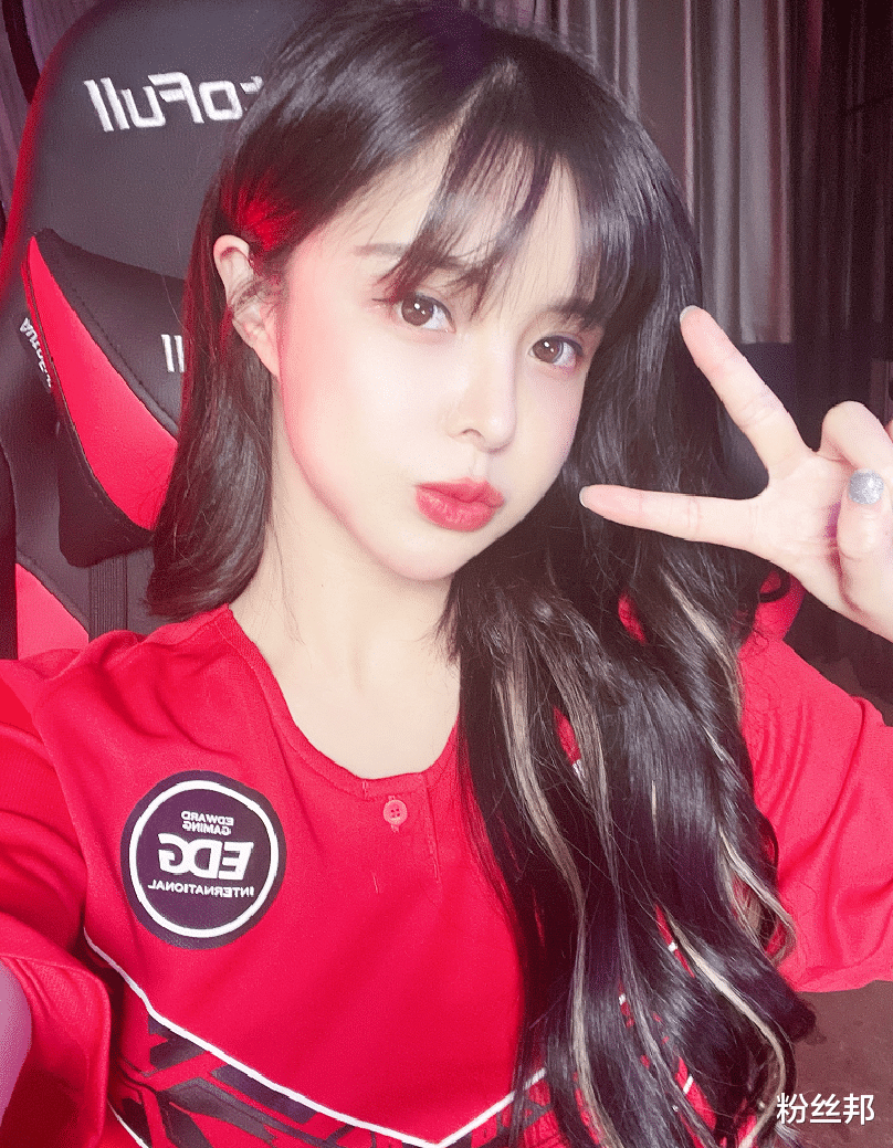 |苏恩腿上淤青有伤，被追问造成的原因，解释喝酒摔倒粉丝秒懂