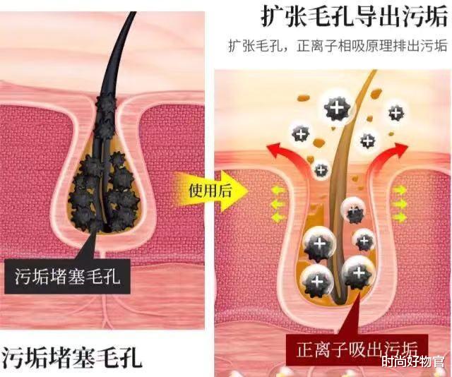 时尚好物官|有一种整容叫“吴昕护肤”，痘痘消失皮肤变白，私下坚持用美容仪