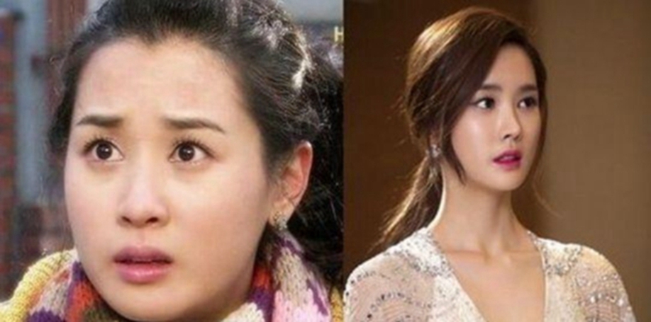 整容|娱乐圈被玻尿酸毁了的女星们，整好了那叫蜕变，整不好那叫恐怖片