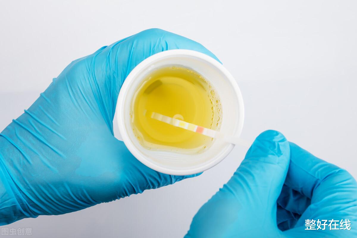 |尿常规大部分人都做错了，想要准确的检测结果就要选择这样留尿