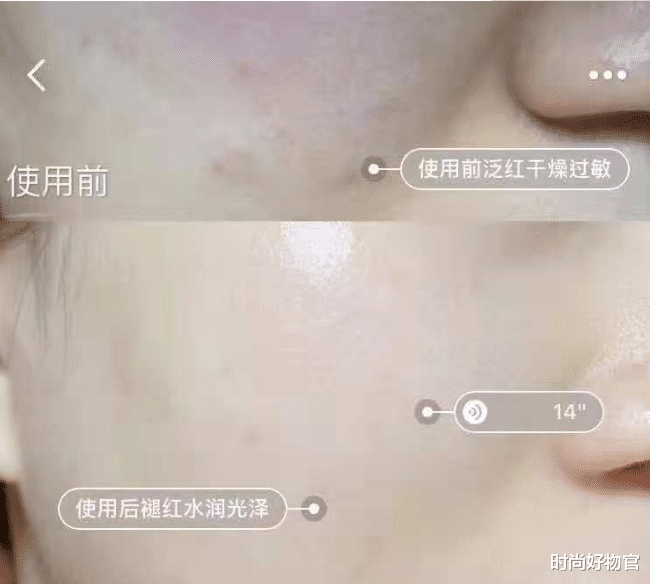 王鸥|王鸥自曝瘦脸针打到脸僵，但是卸妆素颜后，网友表示：太美了