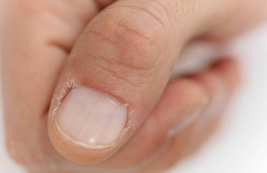 肝脏|身上2处“开裂”,肝脏或已“遍体鳞伤”,若占其一,趁早查肝CT