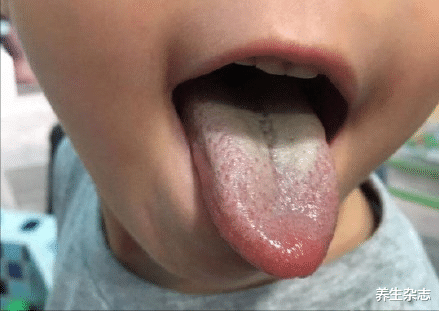 养生杂志|睡觉怎么都睡不醒,是哪里出了问题?这个养生糕,帮了很多人