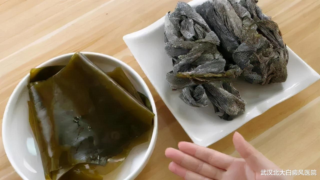 海带|这种菜不止对白癜风康复有益,还有其他妙用,你一定吃过