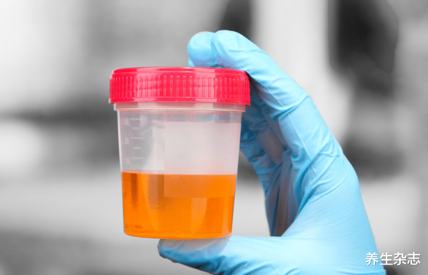 肝脏|1毫克就能致癌？厨房里2种物品，暗藏致癌物，建议你定期更换