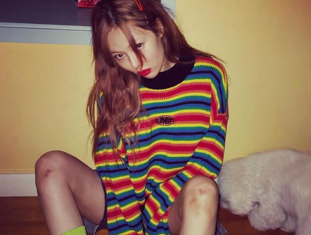 90后宝妈经验|女生膝盖上的淤青到底是怎么来的？从科学的角度告诉你真实原因