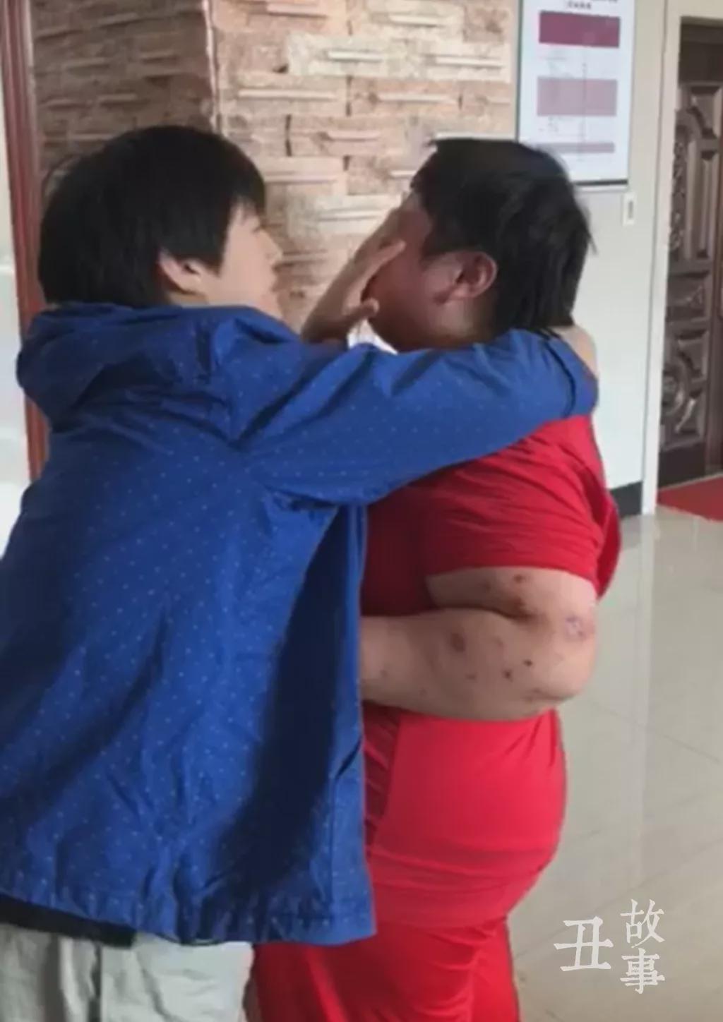 丑故事|女儿刚出生就患了怪病,不吃不喝,长大后又吃到停不下来