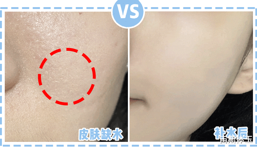 爽肤水 经常为肌肤补水，但肌肤状态还是没有改善？注意这2个误区
