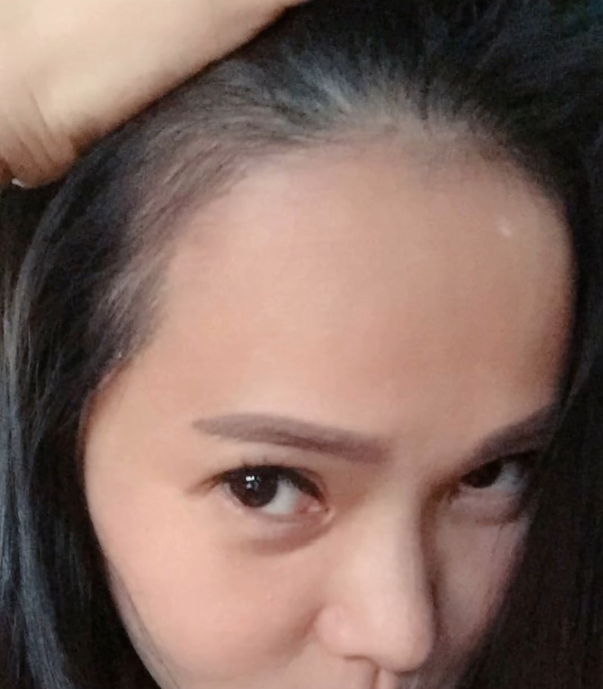 伊能静|伊能静称高龄产女恢复差，严重贫血致掉发，不舍得花15万元生发