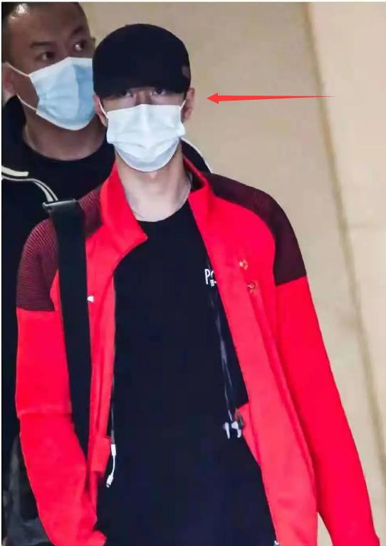 王一博|王一博疑似整容失败？鼻梁乌青发黑，被质疑刚取了假体？