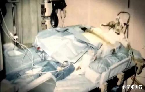 行星 一次核事故让他全身DNA破裂，最终看着自己的身体逐渐腐烂