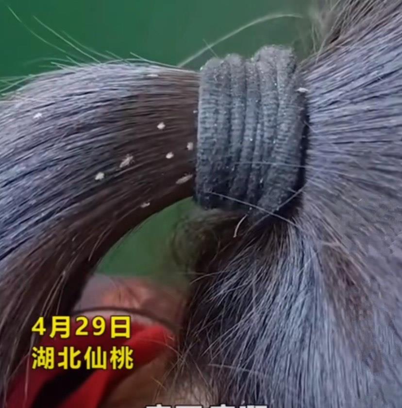 蔡宏志聊时尚 湖北女孩虱子满头爬，只因父母在外务工不在家，可怜又可悲